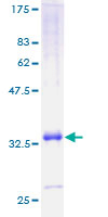 CXCL11 Protein - 12.5% SDS-PAGE of human CXCL11 stained with Coomassie Blue