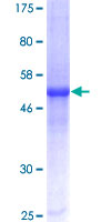 CXCL16 Protein - 12.5% SDS-PAGE of human CXCL16 stained with Coomassie Blue