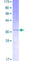CXCL3 / GRO Gamma Protein - 12.5% SDS-PAGE of human CXCL3 stained with Coomassie Blue