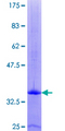 CXCL4 / PF4 Protein - 12.5% SDS-PAGE of human PF4 stained with Coomassie Blue