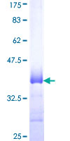 CXCL4 / PF4 Protein - 12.5% SDS-PAGE Stained with Coomassie Blue.