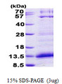 CXCL4 / PF4 Protein