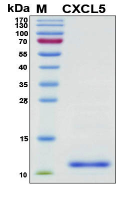 CXCL5 Protein - SDS-PAGE under reducing conditions and visualized by Coomassie blue staining