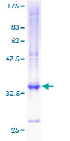 CXCL5 Protein - 12.5% SDS-PAGE of human CXCL5 stained with Coomassie Blue