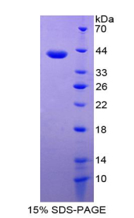 CXCL5 Protein - Recombinant Epithelial Neutrophil Activating Peptide 78 By SDS-PAGE