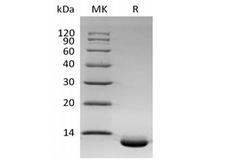 CXCL6 Protein - Recombinant Human C-X-C Motif Chemokine 6/CXCL6 (C-6His)