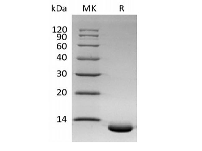 CXCL6 Protein - Recombinant Human C-X-C Motif Chemokine 6/CXCL6 (C-6His)