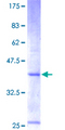 CXCL6 Protein - 12.5% SDS-PAGE of human CXCL6 stained with Coomassie Blue