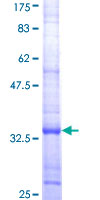 CXCL6 Protein - 12.5% SDS-PAGE Stained with Coomassie Blue.