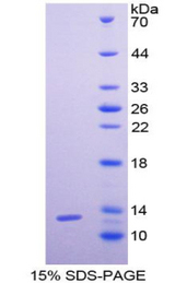 CXCL6 Protein - Recombinant Granulocyte Chemotactic Protein 2 By SDS-PAGE
