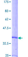CXCL7 / PPBP Protein - 12.5% SDS-PAGE of human PPBP stained with Coomassie Blue