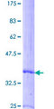 CXCL7 / PPBP Protein - 12.5% SDS-PAGE of human PPBP stained with Coomassie Blue