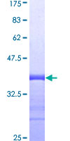 CXCL7 / PPBP Protein - 12.5% SDS-PAGE Stained with Coomassie Blue.