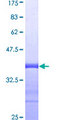 CXCL7 / PPBP Protein - 12.5% SDS-PAGE Stained with Coomassie Blue.