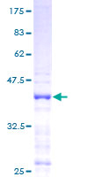 CXCL9 / MIG Protein - 12.5% SDS-PAGE of human CXCL9 stained with Coomassie Blue