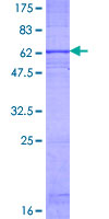 CXCR1 Protein - 12.5% SDS-PAGE of human CXCR1 stained with Coomassie Blue