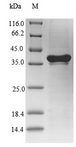 CXCR2 Protein - (Tris-Glycine gel) Discontinuous SDS-PAGE (reduced) with 5% enrichment gel and 15% separation gel.