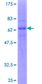 CXCR2 Protein - 12.5% SDS-PAGE of human CXCR2 stained with Coomassie Blue