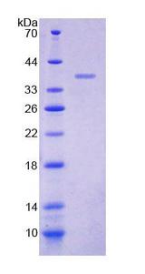 CXCR2 Protein - Recombinant Interleukin 8 Receptor Beta (IL8Rb) by SDS-PAGE