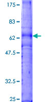 CXCR3 Protein - 12.5% SDS-PAGE of human CXCR3 stained with Coomassie Blue
