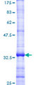 CXCR3 Protein - 12.5% SDS-PAGE Stained with Coomassie Blue.