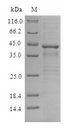 CXCR4 Protein - (Tris-Glycine gel) Discontinuous SDS-PAGE (reduced) with 5% enrichment gel and 15% separation gel.