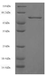 CXCR4 Protein - (Tris-Glycine gel) Discontinuous SDS-PAGE (reduced) with 5% enrichment gel and 15% separation gel.