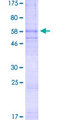 CXCR4 Protein - 12.5% SDS-PAGE of human CXCR4 stained with Coomassie Blue