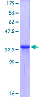 CXCR4 Protein - 12.5% SDS-PAGE Stained with Coomassie Blue.