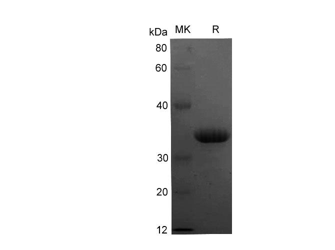 CXCR4 Protein - Recombinant Human CXCR4 (C28A) Protein (His Tag)