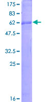CXCR6 Protein - 12.5% SDS-PAGE of human CXCR6 stained with Coomassie Blue