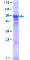 CXorf21 Protein - 12.5% SDS-PAGE of human CXorf21 stained with Coomassie Blue
