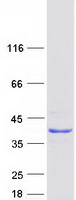 CXorf26 Protein - Purified recombinant protein PBDC1 was analyzed by SDS-PAGE gel and Coomassie Blue Staining