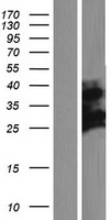 CXorf38 Protein - Western validation with an anti-DDK antibody * L: Control HEK293 lysate R: Over-expression lysate