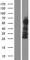 CXorf49B Protein - Western validation with an anti-DDK antibody * L: Control HEK293 lysate R: Over-expression lysate