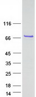 CXorf49B Protein - Purified recombinant protein CXorf49B was analyzed by SDS-PAGE gel and Coomassie Blue Staining