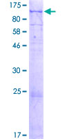 CXorf57 Protein - 12.5% SDS-PAGE of human CXorf57 stained with Coomassie Blue