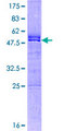 CXXC4 Protein - 12.5% SDS-PAGE of human CXXC4 stained with Coomassie Blue