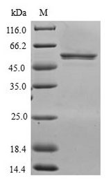 CXXC4 Protein - (Tris-Glycine gel) Discontinuous SDS-PAGE (reduced) with 5% enrichment gel and 15% separation gel.