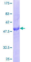 CXXC5 Protein - 12.5% SDS-PAGE of human CXXC5 stained with Coomassie Blue