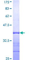 CXXC5 Protein - 12.5% SDS-PAGE Stained with Coomassie Blue.