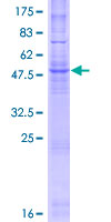 CYB561 Protein - 12.5% SDS-PAGE of human CYB561 stained with Coomassie Blue