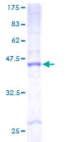 CYB561D2 Protein - 12.5% SDS-PAGE of human CYB561D2 stained with Coomassie Blue
