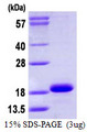 CYB5A / Cytochrome b5 Protein
