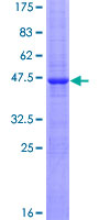 CYB5B Protein - 12.5% SDS-PAGE of human CYB5-M stained with Coomassie Blue