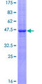 CYB5B Protein - 12.5% SDS-PAGE of human CYB5-M stained with Coomassie Blue