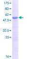 CYB5D1 Protein - 12.5% SDS-PAGE of human CYB5D1 stained with Coomassie Blue