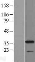 CYB5R1 Protein - Western validation with an anti-DDK antibody * L: Control HEK293 lysate R: Over-expression lysate