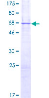 CYB5R1 Protein - 12.5% SDS-PAGE of human CYB5R1 stained with Coomassie Blue