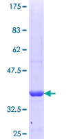 CYB5R1 Protein - 12.5% SDS-PAGE Stained with Coomassie Blue.